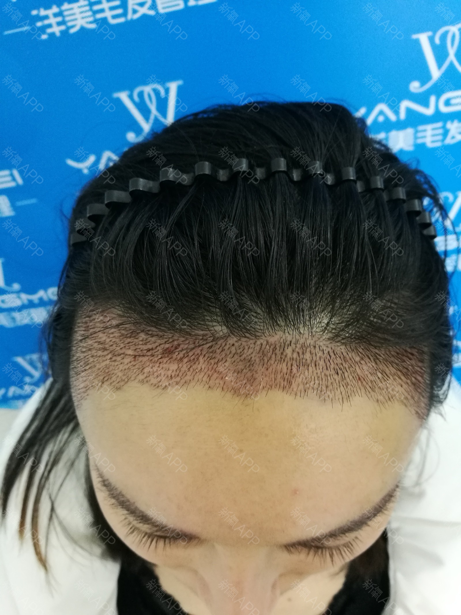 ky.com|山东菏泽巨大木材需求量拉动木材价格(图1)